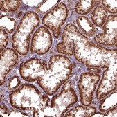 Anti-HYAL1 antibody produced in rabbit Prestige Antibodies&#174; Powered by Atlas Antibodies, affinity isolated antibody, buffered aqueous glycerol solution