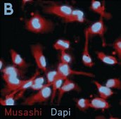 Human Neural Stem Cell Characterization Kit The Human Neural Stem Cell Characterization Kit contains three molecular markers, Nestin, Sox 2 &amp; Musashi that are frequently used to identify neural stem/progenitor cells.