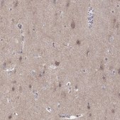 Anti-ABL2 antibody produced in rabbit Prestige Antibodies&#174; Powered by Atlas Antibodies, affinity isolated antibody