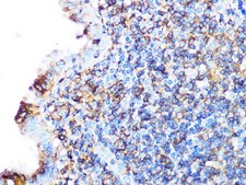 Anti-Arp3 antibody produced in rabbit