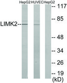 Anti-LIMK2 antibody produced in rabbit affinity isolated antibody
