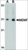 Anti-NENF antibody produced in rabbit affinity isolated antibody, buffered aqueous solution