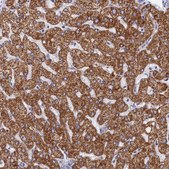 Anti-MMAB antibody produced in rabbit Prestige Antibodies&#174; Powered by Atlas Antibodies, affinity isolated antibody, buffered aqueous glycerol solution