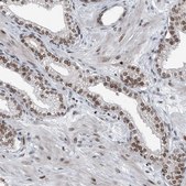 Anti-BMI1 antibody produced in rabbit Prestige Antibodies&#174; Powered by Atlas Antibodies, affinity isolated antibody, buffered aqueous glycerol solution