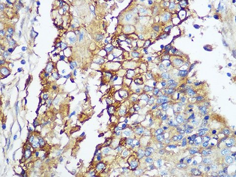 Anti-Carbonic Anhydrase 9 (CA9/G250) antibody produced in rabbit