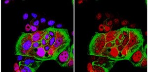 Anti-phospho-BRCA2 (Ser3291) Antibody from rabbit, purified by affinity chromatography