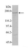 Anti-SENP6 antibody produced in rabbit affinity isolated antibody