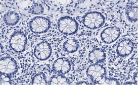 Anti-PSMB2 Antibody, clone 2N18 ZooMAb&#174; Rabbit Monoclonal recombinant, expressed in HEK 293 cells