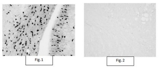 Anti-Aspa/Nur7 Antibody from rabbit, purified by affinity chromatography