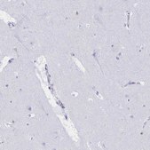Anti-MYO1F antibody produced in rabbit Prestige Antibodies&#174; Powered by Atlas Antibodies, affinity isolated antibody, buffered aqueous glycerol solution