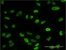 Monoclonal Anti-PPP3CA antibody produced in mouse clone 2G8, purified immunoglobulin, buffered aqueous solution