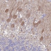 Anti-CACNA2D2 antibody produced in rabbit Prestige Antibodies&#174; Powered by Atlas Antibodies, affinity isolated antibody, buffered aqueous glycerol solution