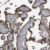 Anti-P2RY1 antibody produced in rabbit Prestige Antibodies&#174; Powered by Atlas Antibodies, affinity isolated antibody, buffered aqueous glycerol solution