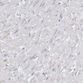 Anti-AMPD1 antibody produced in rabbit Prestige Antibodies&#174; Powered by Atlas Antibodies, affinity isolated antibody, buffered aqueous glycerol solution, ab2