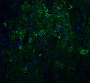 Anti-Nicastrin (ab2) antibody produced in rabbit affinity isolated antibody, buffered aqueous solution