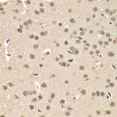 Anti-CSNK1E antibody produced in rabbit
