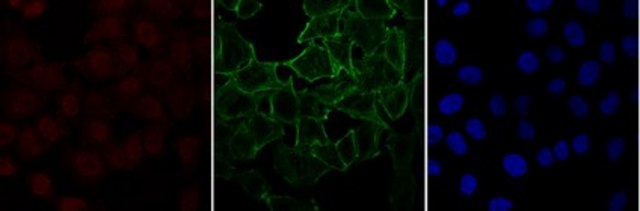 Anti-monomethyl Histone H4 (Lys20), Alexa Fluor&#8482; 555 conjugate from rabbit, ALEXA FLUOR&#8482; 555