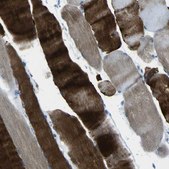 Anti-PHKG1 antibody produced in rabbit Prestige Antibodies&#174; Powered by Atlas Antibodies, affinity isolated antibody, buffered aqueous glycerol solution