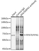 Anti-RPA70/RPA1 Antibody, clone 5R7S3, Rabbit Monoclonal