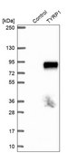Anti-TYRP1 antibody produced in rabbit Prestige Antibodies&#174; Powered by Atlas Antibodies, affinity isolated antibody, buffered aqueous glycerol solution