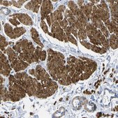 Anti-CNN1 antibody produced in rabbit Prestige Antibodies&#174; Powered by Atlas Antibodies, affinity isolated antibody, buffered aqueous glycerol solution