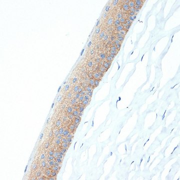 Anti-CRABP1 antibody produced in rabbit