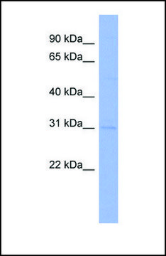 Anti-CLDN18 antibody produced in rabbit affinity isolated antibody