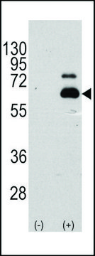ANTI-S6K (RPS6KB1) (S404) antibody produced in rabbit affinity isolated antibody, buffered aqueous solution