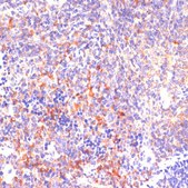 Anti-ROCK1 antibody produced in rabbit