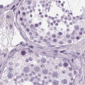 Anti-POMC antibody produced in rabbit Prestige Antibodies&#174; Powered by Atlas Antibodies, affinity isolated antibody