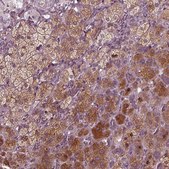 Anti-PORCN antibody produced in rabbit Prestige Antibodies&#174; Powered by Atlas Antibodies, affinity isolated antibody