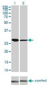 Monoclonal Anti-CDK4 antibody produced in mouse clone 4F11, purified immunoglobulin, buffered aqueous solution