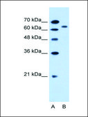 Anti-SLC22A3 affinity isolated antibody