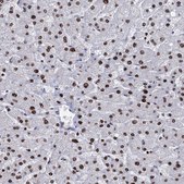 Anti-DCPS antibody produced in rabbit Prestige Antibodies&#174; Powered by Atlas Antibodies, affinity isolated antibody, buffered aqueous glycerol solution