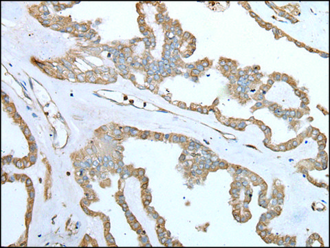 Anti-SPTA1 affinity isolated antibody