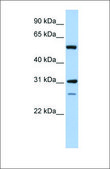 Anti-IMPDH1 antibody produced in rabbit affinity isolated antibody