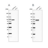 Anti-TGM2 antibody produced in rabbit Prestige Antibodies&#174; Powered by Atlas Antibodies, affinity isolated antibody, buffered aqueous glycerol solution