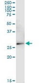 Monoclonal Anti-VDAC2 antibody produced in mouse clone 3D2, purified immunoglobulin, buffered aqueous solution