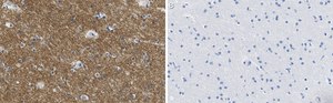 Anti-KCNQ2 Antibody, clone 2G18 ZooMAb® Rabbit Monoclonal recombinant, expressed in HEK 293 cells