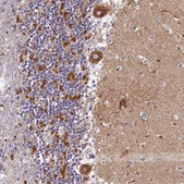 Anti-VDAC2 antibody produced in rabbit Prestige Antibodies&#174; Powered by Atlas Antibodies, affinity isolated antibody, buffered aqueous glycerol solution