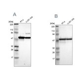 Anti-PDIA3 antibody produced in rabbit Ab1, Prestige Antibodies&#174; Powered by Atlas Antibodies, affinity isolated antibody, buffered aqueous glycerol solution