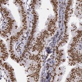 Anti-HNRNPH2 antibody produced in rabbit Ab1, Prestige Antibodies&#174; Powered by Atlas Antibodies, affinity isolated antibody, buffered aqueous glycerol solution