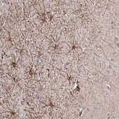 Anti-DNAL1 antibody produced in rabbit Prestige Antibodies&#174; Powered by Atlas Antibodies, affinity isolated antibody, buffered aqueous glycerol solution