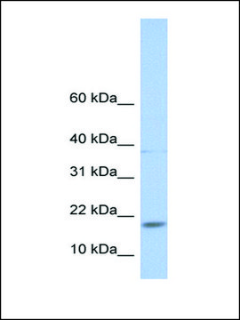 Anti-MAX antibody produced in rabbit affinity isolated antibody