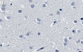 Anti-MEF2C Antibody, clone 1D21 ZooMAb&#174; Rabbit Monoclonal recombinant, expressed in HEK 293 cells