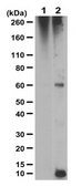 Anti-Modified Citrulline Antibody, clone C4 clone C4, from human(Recombinant)