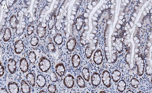 Anti-Vitamin D3 Receptor Antibody, clone 1M19 ZooMAb&#174; Rabbit Monoclonal recombinant, expressed in HEK 293 cells