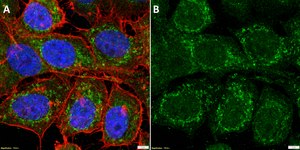 Anti-CHCHD10 Antibody, clone 3J12 ZooMAb&#174; Rabbit Monoclonal recombinant, expressed in HEK 293 cells