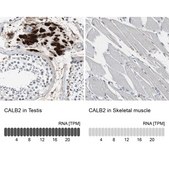 Anti-CALB2 antibody produced in rabbit Prestige Antibodies&#174; Powered by Atlas Antibodies, affinity isolated antibody, buffered aqueous glycerol solution