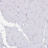 Anti-MYH10 antibody produced in rabbit Prestige Antibodies&#174; Powered by Atlas Antibodies, affinity isolated antibody, buffered aqueous glycerol solution